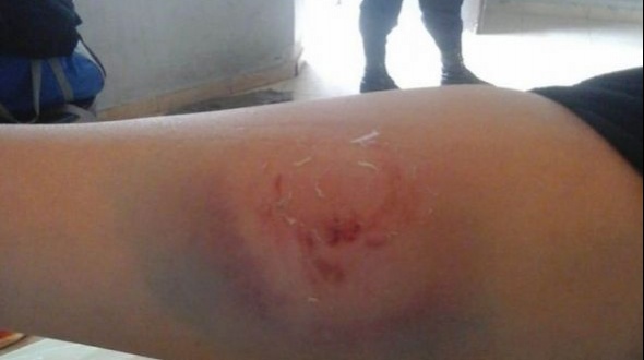 Capital: Jovencita mordió a policía durante un control de rutina