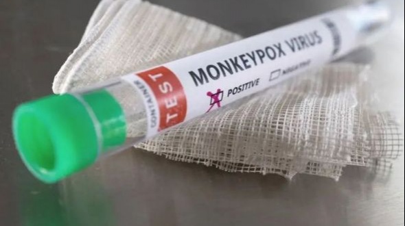 Viruela del mono: La OMS declaró la emergencia internacional por la suba de casos 