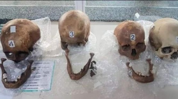 Formosa: Pasajera llevaba cuatro cráneos humanos en el equipaje