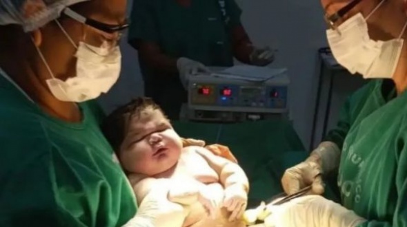 Nació un superbebé de más de 7 kilos y rompió un récord en Brasil